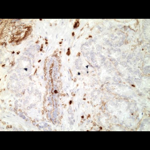  NCBI Organism:Homo sapiens; Cell Types:endocrine-paracrine cell of prostate gland, basal cell of prostate epithelium, luminal cell of prostate epithelium, blood vessel endothelial cell, perineural cell, sheath cell, leukocyte, prostate stromal cell, smooth muscle cell of prostate; Cell Components:nucleus, cell surface;