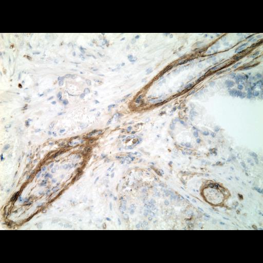  NCBI Organism:Homo sapiens; Cell Types:endocrine-paracrine cell of prostate gland, basal cell of prostate epithelium, luminal cell of prostate epithelium, blood vessel endothelial cell, perineural cell, sheath cell, leukocyte, prostate stromal cell, smooth muscle cell of prostate; Cell Components:nucleus, cell surface;