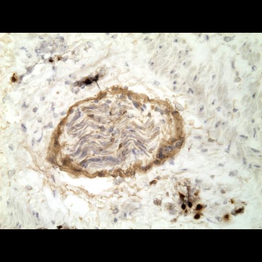  NCBI Organism:Homo sapiens; Cell Types:endocrine-paracrine cell of prostate gland, basal cell of prostate epithelium, luminal cell of prostate epithelium, blood vessel endothelial cell, perineural cell, sheath cell, leukocyte, prostate stromal cell, smooth muscle cell of prostate; Cell Components:nucleus, cell surface;