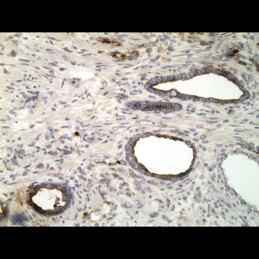  NCBI Organism:Homo sapiens; Cell Types:endocrine-paracrine cell of prostate gland, basal cell of prostate epithelium, luminal cell of prostate epithelium, blood vessel endothelial cell, perineural cell, sheath cell, leukocyte, prostate stromal cell, smooth muscle cell of prostate; Cell Components:nucleus, cell surface;