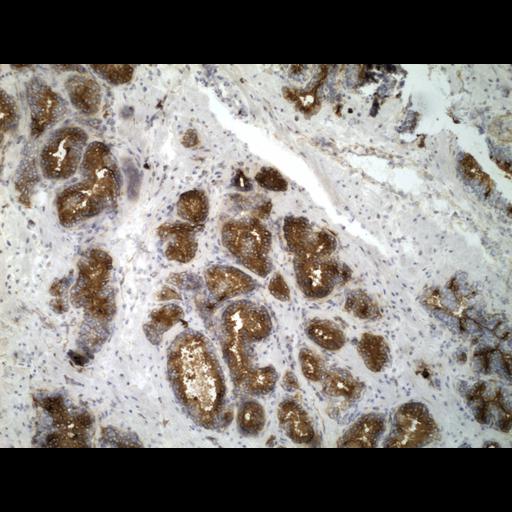  NCBI Organism:Homo sapiens; Cell Types:endocrine-paracrine cell of prostate gland, basal cell of prostate epithelium, luminal cell of prostate epithelium, blood vessel endothelial cell, perineural cell, sheath cell, leukocyte, prostate stromal cell, smooth muscle cell of prostate; Cell Components:nucleus, cell surface;