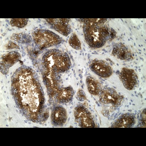  NCBI Organism:Homo sapiens; Cell Types:endocrine-paracrine cell of prostate gland, basal cell of prostate epithelium, luminal cell of prostate epithelium, blood vessel endothelial cell, perineural cell, sheath cell, leukocyte, prostate stromal cell, smooth muscle cell of prostate; Cell Components:nucleus, cell surface;