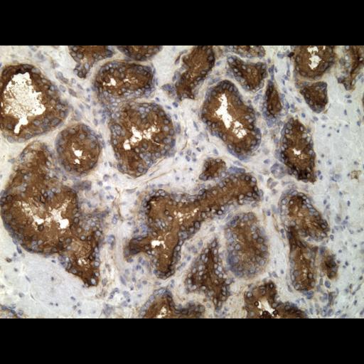  NCBI Organism:Homo sapiens; Cell Types:endocrine-paracrine cell of prostate gland, basal cell of prostate epithelium, luminal cell of prostate epithelium, blood vessel endothelial cell, perineural cell, sheath cell, leukocyte, prostate stromal cell, smooth muscle cell of prostate; Cell Components:nucleus, cell surface;