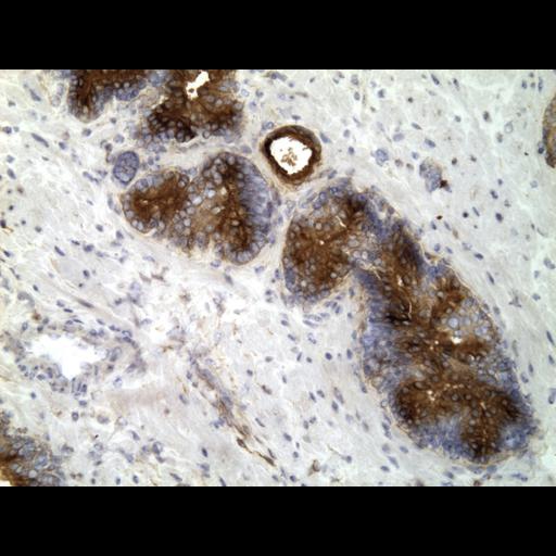  NCBI Organism:Homo sapiens; Cell Types:endocrine-paracrine cell of prostate gland, basal cell of prostate epithelium, luminal cell of prostate epithelium, blood vessel endothelial cell, perineural cell, sheath cell, leukocyte, prostate stromal cell, smooth muscle cell of prostate; Cell Components:nucleus, cell surface;