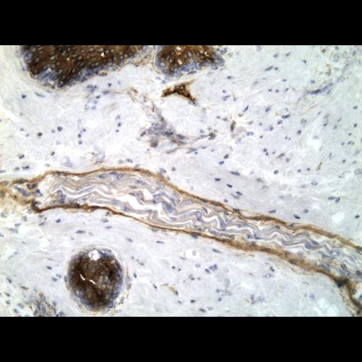  NCBI Organism:Homo sapiens; Cell Types:endocrine-paracrine cell of prostate gland, basal cell of prostate epithelium, luminal cell of prostate epithelium, blood vessel endothelial cell, perineural cell, sheath cell, leukocyte, prostate stromal cell, smooth muscle cell of prostate; Cell Components:nucleus, cell surface;