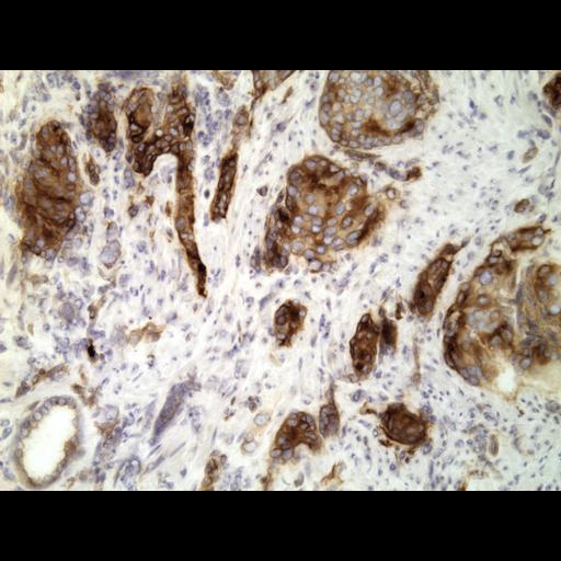  NCBI Organism:Homo sapiens; Cell Types:endocrine-paracrine cell of prostate gland, basal cell of prostate epithelium, luminal cell of prostate epithelium, blood vessel endothelial cell, perineural cell, sheath cell, leukocyte, prostate stromal cell, smooth muscle cell of prostate; Cell Components:nucleus, cell surface;