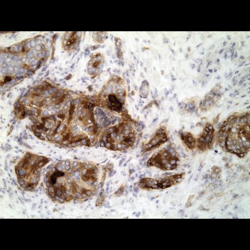  NCBI Organism:Homo sapiens; Cell Types:endocrine-paracrine cell of prostate gland, basal cell of prostate epithelium, luminal cell of prostate epithelium, blood vessel endothelial cell, perineural cell, sheath cell, leukocyte, prostate stromal cell, smooth muscle cell of prostate; Cell Components:nucleus, cell surface;