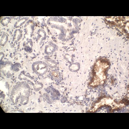  NCBI Organism:Homo sapiens; Cell Types:endocrine-paracrine cell of prostate gland, basal cell of prostate epithelium, luminal cell of prostate epithelium, blood vessel endothelial cell, perineural cell, sheath cell, leukocyte, prostate stromal cell, smooth muscle cell of prostate; Cell Components:nucleus, cell surface;