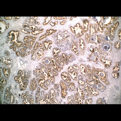  NCBI Organism:Homo sapiens; Cell Types:endocrine-paracrine cell of prostate gland, basal cell of prostate epithelium, luminal cell of prostate epithelium, blood vessel endothelial cell, perineural cell, sheath cell, leukocyte, prostate stromal cell, smooth muscle cell of prostate; Cell Components:nucleus, cell surface;