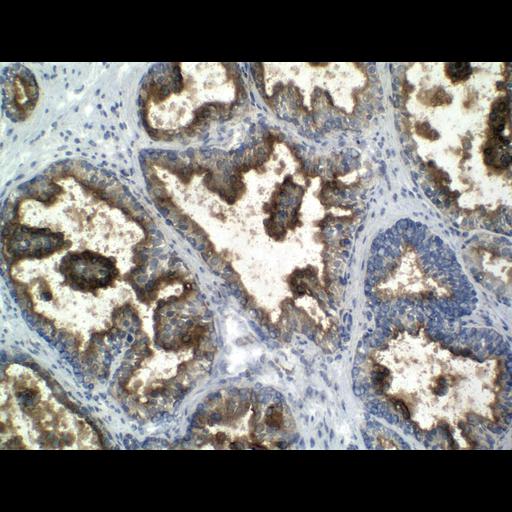  NCBI Organism:Homo sapiens; Cell Types:endocrine-paracrine cell of prostate gland, basal cell of prostate epithelium, luminal cell of prostate epithelium, blood vessel endothelial cell, perineural cell, sheath cell, leukocyte, prostate stromal cell, smooth muscle cell of prostate; Cell Components:nucleus, cell surface;