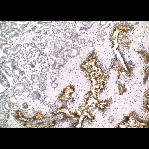  NCBI Organism:Homo sapiens; Cell Types:endocrine-paracrine cell of prostate gland, basal cell of prostate epithelium, luminal cell of prostate epithelium, blood vessel endothelial cell, perineural cell, sheath cell, leukocyte, prostate stromal cell, smooth muscle cell of prostate; Cell Components:nucleus, cell surface;