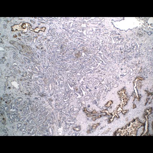  NCBI Organism:Homo sapiens; Cell Types:endocrine-paracrine cell of prostate gland, basal cell of prostate epithelium, luminal cell of prostate epithelium, blood vessel endothelial cell, perineural cell, sheath cell, leukocyte, prostate stromal cell, smooth muscle cell of prostate; Cell Components:nucleus, cell surface;