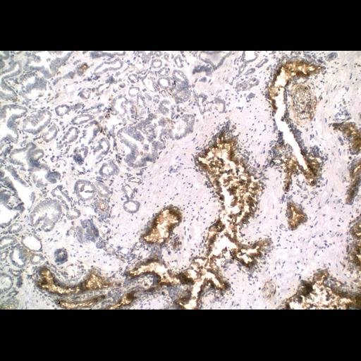  NCBI Organism:Homo sapiens; Cell Types:endocrine-paracrine cell of prostate gland, basal cell of prostate epithelium, luminal cell of prostate epithelium, blood vessel endothelial cell, perineural cell, sheath cell, leukocyte, prostate stromal cell, smooth muscle cell of prostate; Cell Components:nucleus, cell surface;