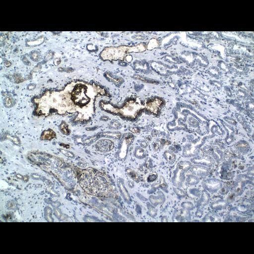  NCBI Organism:Homo sapiens; Cell Types:endocrine-paracrine cell of prostate gland, basal cell of prostate epithelium, luminal cell of prostate epithelium, blood vessel endothelial cell, perineural cell, sheath cell, leukocyte, prostate stromal cell, smooth muscle cell of prostate; Cell Components:nucleus, cell surface;