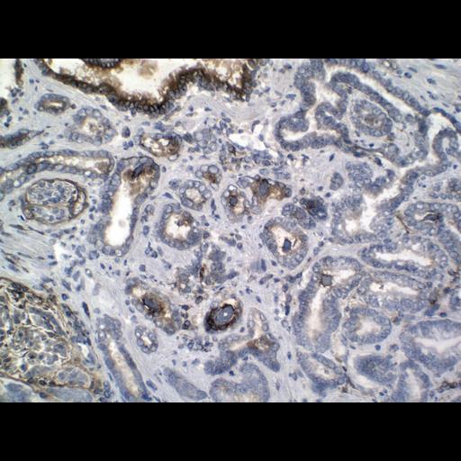  NCBI Organism:Homo sapiens; Cell Types:endocrine-paracrine cell of prostate gland, basal cell of prostate epithelium, luminal cell of prostate epithelium, blood vessel endothelial cell, perineural cell, sheath cell, leukocyte, prostate stromal cell, smooth muscle cell of prostate; Cell Components:nucleus, cell surface;