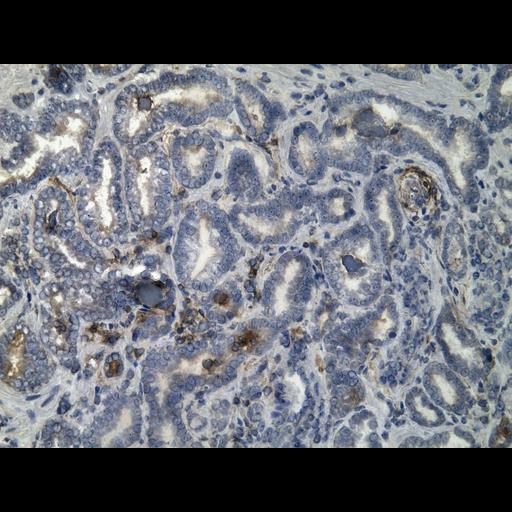  NCBI Organism:Homo sapiens; Cell Types:endocrine-paracrine cell of prostate gland, basal cell of prostate epithelium, luminal cell of prostate epithelium, blood vessel endothelial cell, perineural cell, sheath cell, leukocyte, prostate stromal cell, smooth muscle cell of prostate; Cell Components:nucleus, cell surface;