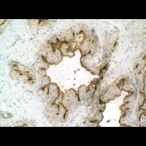  NCBI Organism:Homo sapiens; Cell Types:endocrine-paracrine cell of prostate gland, basal cell of prostate epithelium, luminal cell of prostate epithelium, blood vessel endothelial cell, perineural cell, sheath cell, leukocyte, prostate stromal cell, smooth muscle cell of prostate; Cell Components:nucleus, cell surface;