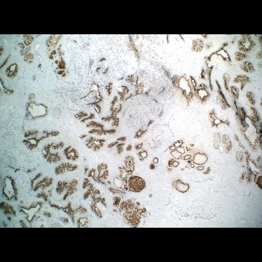  NCBI Organism:Homo sapiens; Cell Types:endocrine-paracrine cell of prostate gland, basal cell of prostate epithelium, luminal cell of prostate epithelium, blood vessel endothelial cell, perineural cell, sheath cell, leukocyte, prostate stromal cell, smooth muscle cell of prostate; Cell Components:nucleus, cell surface;