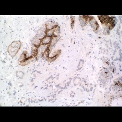  NCBI Organism:Homo sapiens; Cell Types:endocrine-paracrine cell of prostate gland, basal cell of prostate epithelium, luminal cell of prostate epithelium, blood vessel endothelial cell, perineural cell, sheath cell, leukocyte, prostate stromal cell, smooth muscle cell of prostate; Cell Components:nucleus, cell surface;