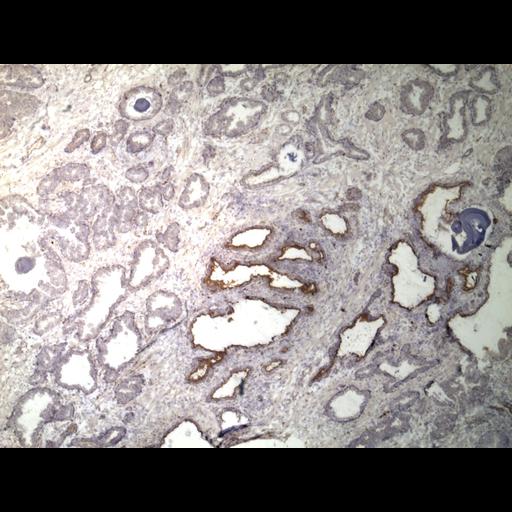  NCBI Organism:Homo sapiens; Cell Types:endocrine-paracrine cell of prostate gland, basal cell of prostate epithelium, luminal cell of prostate epithelium, blood vessel endothelial cell, perineural cell, sheath cell, leukocyte, prostate stromal cell, smooth muscle cell of prostate; Cell Components:nucleus, cell surface;