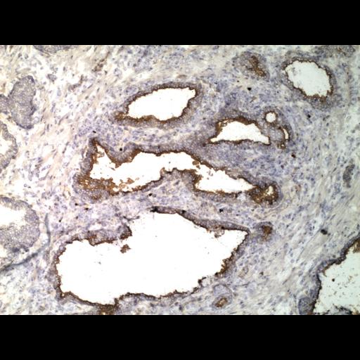  NCBI Organism:Homo sapiens; Cell Types:endocrine-paracrine cell of prostate gland, basal cell of prostate epithelium, luminal cell of prostate epithelium, blood vessel endothelial cell, perineural cell, sheath cell, leukocyte, prostate stromal cell, smooth muscle cell of prostate; Cell Components:nucleus, cell surface;