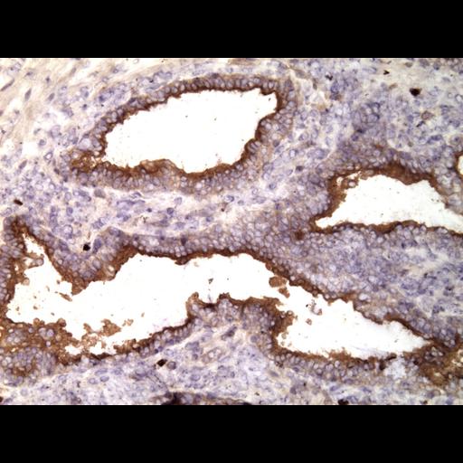  NCBI Organism:Homo sapiens; Cell Types:endocrine-paracrine cell of prostate gland, basal cell of prostate epithelium, luminal cell of prostate epithelium, blood vessel endothelial cell, perineural cell, sheath cell, leukocyte, prostate stromal cell, smooth muscle cell of prostate; Cell Components:nucleus, cell surface;