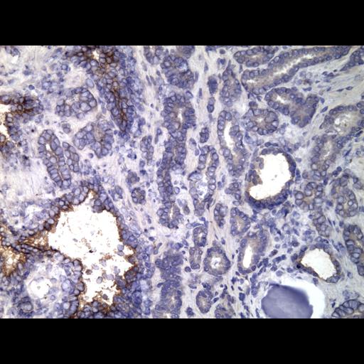  NCBI Organism:Homo sapiens; Cell Types:endocrine-paracrine cell of prostate gland, basal cell of prostate epithelium, luminal cell of prostate epithelium, blood vessel endothelial cell, perineural cell, sheath cell, leukocyte, prostate stromal cell, smooth muscle cell of prostate; Cell Components:nucleus, cell surface;