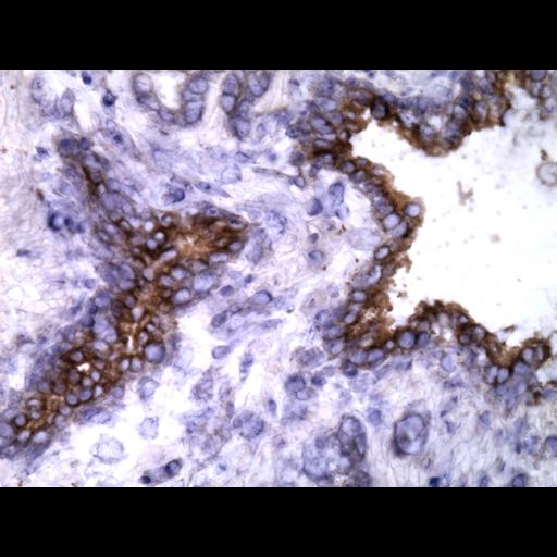  NCBI Organism:Homo sapiens; Cell Types:endocrine-paracrine cell of prostate gland, basal cell of prostate epithelium, luminal cell of prostate epithelium, blood vessel endothelial cell, perineural cell, sheath cell, leukocyte, prostate stromal cell, smooth muscle cell of prostate; Cell Components:nucleus, cell surface;