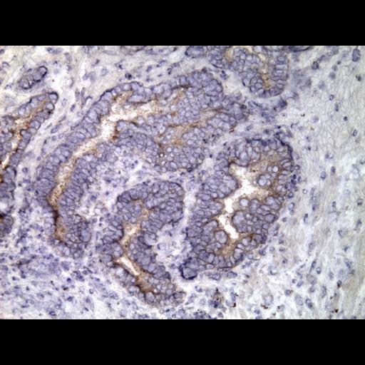  NCBI Organism:Homo sapiens; Cell Types:endocrine-paracrine cell of prostate gland, basal cell of prostate epithelium, luminal cell of prostate epithelium, blood vessel endothelial cell, perineural cell, sheath cell, leukocyte, prostate stromal cell, smooth muscle cell of prostate; Cell Components:nucleus, cell surface;