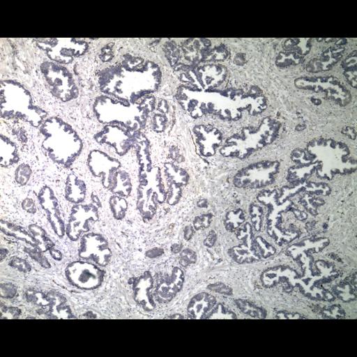  NCBI Organism:Homo sapiens; Cell Types:endocrine-paracrine cell of prostate gland, basal cell of prostate epithelium, luminal cell of prostate epithelium, blood vessel endothelial cell, perineural cell, sheath cell, leukocyte, prostate stromal cell, smooth muscle cell of prostate; Cell Components:nucleus, cell surface;