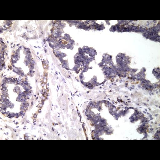  NCBI Organism:Homo sapiens; Cell Types:endocrine-paracrine cell of prostate gland, basal cell of prostate epithelium, luminal cell of prostate epithelium, blood vessel endothelial cell, perineural cell, sheath cell, leukocyte, prostate stromal cell, smooth muscle cell of prostate; Cell Components:nucleus, cell surface;