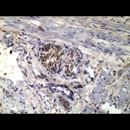  NCBI Organism:Homo sapiens; Cell Types:endocrine-paracrine cell of prostate gland, basal cell of prostate epithelium, luminal cell of prostate epithelium, blood vessel endothelial cell, perineural cell, sheath cell, leukocyte, prostate stromal cell, smooth muscle cell of prostate; Cell Components:nucleus, cell surface;