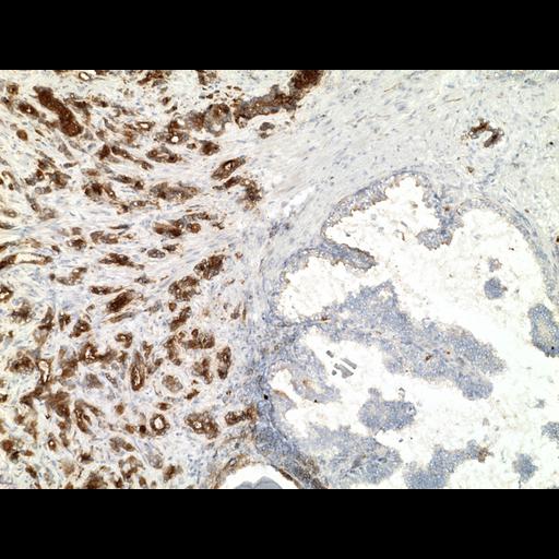  NCBI Organism:Homo sapiens; Cell Types:endocrine-paracrine cell of prostate gland, basal cell of prostate epithelium, luminal cell of prostate epithelium, blood vessel endothelial cell, perineural cell, sheath cell, leukocyte, prostate stromal cell, smooth muscle cell of prostate; Cell Components:nucleus, cell surface;