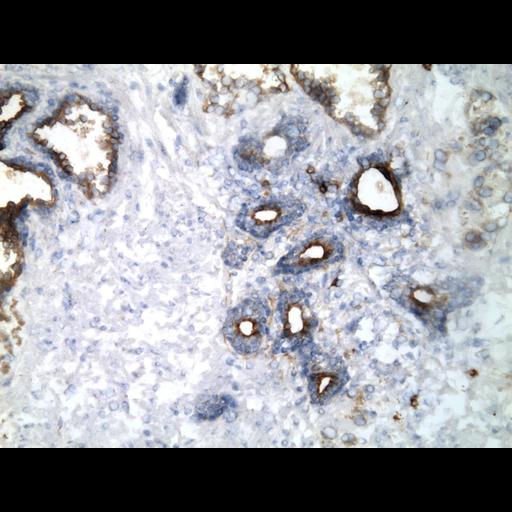  NCBI Organism:Homo sapiens; Cell Types:endocrine-paracrine cell of prostate gland, basal cell of prostate epithelium, luminal cell of prostate epithelium, blood vessel endothelial cell, perineural cell, sheath cell, leukocyte, prostate stromal cell, smooth muscle cell of prostate; Cell Components:nucleus, cell surface;