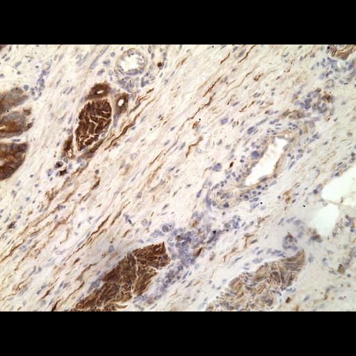  NCBI Organism:Homo sapiens; Cell Types:endocrine-paracrine cell of prostate gland, basal cell of prostate epithelium, luminal cell of prostate epithelium, blood vessel endothelial cell, perineural cell, sheath cell, leukocyte, prostate stromal cell, smooth muscle cell of prostate; Cell Components:nucleus, cell surface;