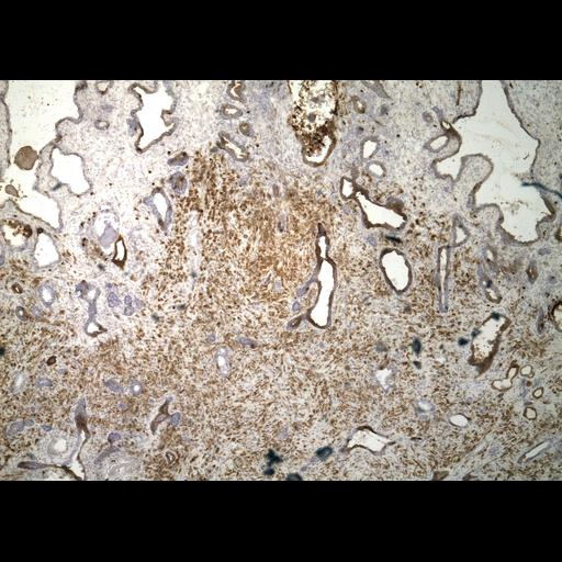  NCBI Organism:Homo sapiens; Cell Types:endocrine-paracrine cell of prostate gland, basal cell of prostate epithelium, luminal cell of prostate epithelium, blood vessel endothelial cell, perineural cell, sheath cell, leukocyte, prostate stromal cell, smooth muscle cell of prostate; Cell Components:nucleus, cell surface;