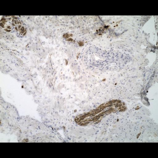  NCBI Organism:Homo sapiens; Cell Types:endocrine-paracrine cell of prostate gland, basal cell of prostate epithelium, luminal cell of prostate epithelium, blood vessel endothelial cell, perineural cell, sheath cell, leukocyte, prostate stromal cell, smooth muscle cell of prostate; Cell Components:nucleus, cell surface;