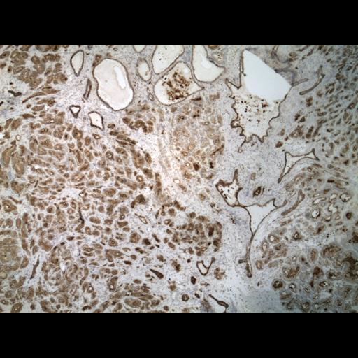  NCBI Organism:Homo sapiens; Cell Types:endocrine-paracrine cell of prostate gland, basal cell of prostate epithelium, luminal cell of prostate epithelium, blood vessel endothelial cell, perineural cell, sheath cell, leukocyte, prostate stromal cell, smooth muscle cell of prostate; Cell Components:nucleus, cell surface;