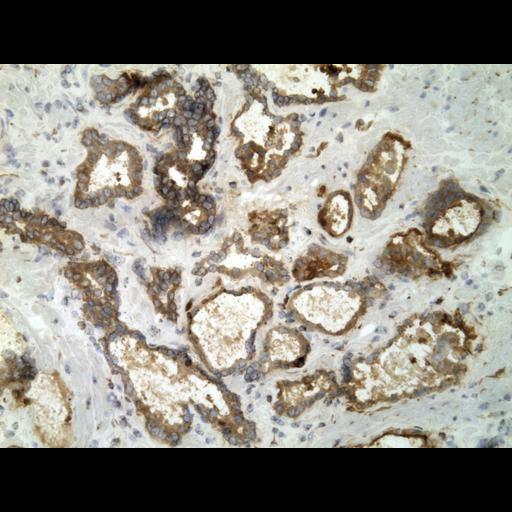  NCBI Organism:Homo sapiens; Cell Types:endocrine-paracrine cell of prostate gland, basal cell of prostate epithelium, luminal cell of prostate epithelium, blood vessel endothelial cell, perineural cell, sheath cell, leukocyte, prostate stromal cell, smooth muscle cell of prostate; Cell Components:nucleus, cell surface;