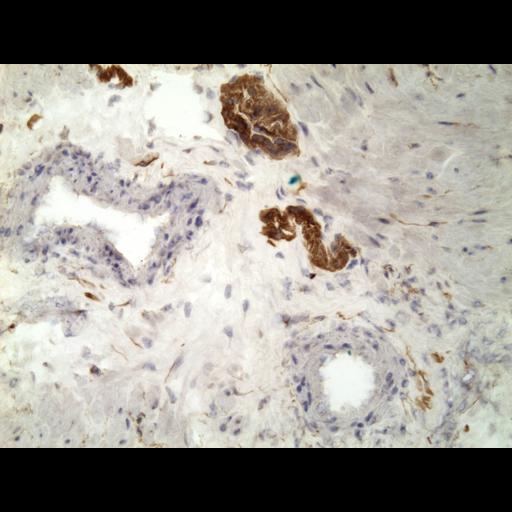  NCBI Organism:Homo sapiens; Cell Types:endocrine-paracrine cell of prostate gland, basal cell of prostate epithelium, luminal cell of prostate epithelium, blood vessel endothelial cell, perineural cell, sheath cell, leukocyte, prostate stromal cell, smooth muscle cell of prostate; Cell Components:nucleus, cell surface;