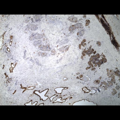  NCBI Organism:Homo sapiens; Cell Types:endocrine-paracrine cell of prostate gland, basal cell of prostate epithelium, luminal cell of prostate epithelium, blood vessel endothelial cell, perineural cell, sheath cell, leukocyte, prostate stromal cell, smooth muscle cell of prostate; Cell Components:nucleus, cell surface;