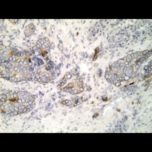  NCBI Organism:Homo sapiens; Cell Types:endocrine-paracrine cell of prostate gland, basal cell of prostate epithelium, luminal cell of prostate epithelium, blood vessel endothelial cell, perineural cell, sheath cell, leukocyte, prostate stromal cell, smooth muscle cell of prostate; Cell Components:nucleus, cell surface;