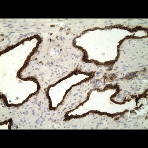  NCBI Organism:Homo sapiens; Cell Types:endocrine-paracrine cell of prostate gland, basal cell of prostate epithelium, luminal cell of prostate epithelium, blood vessel endothelial cell, perineural cell, sheath cell, leukocyte, prostate stromal cell, smooth muscle cell of prostate; Cell Components:nucleus, cell surface;