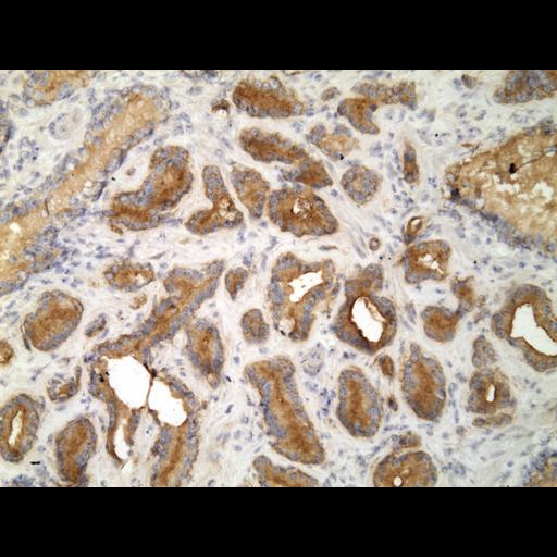  NCBI Organism:Homo sapiens; Cell Types:endocrine-paracrine cell of prostate gland, basal cell of prostate epithelium, luminal cell of prostate epithelium, blood vessel endothelial cell, perineural cell, sheath cell, leukocyte, prostate stromal cell, smooth muscle cell of prostate; Cell Components:nucleus, cell surface;