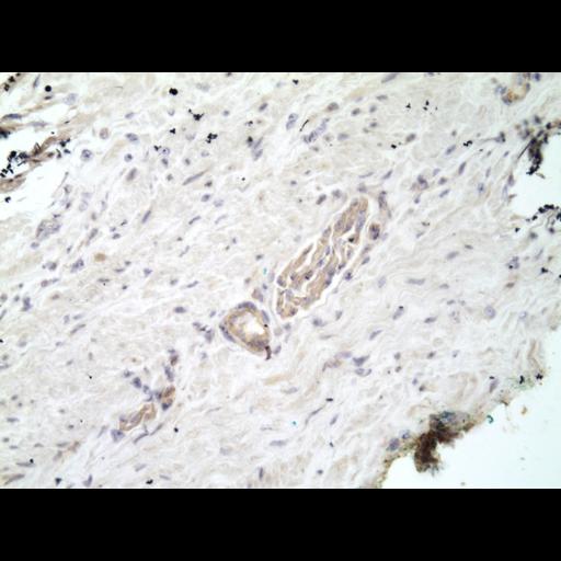  NCBI Organism:Homo sapiens; Cell Types:endocrine-paracrine cell of prostate gland, basal cell of prostate epithelium, luminal cell of prostate epithelium, blood vessel endothelial cell, perineural cell, sheath cell, leukocyte, prostate stromal cell, smooth muscle cell of prostate; Cell Components:nucleus, cell surface;