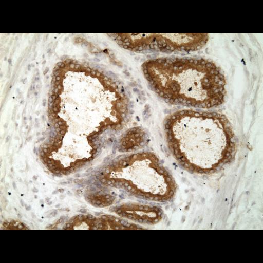  NCBI Organism:Homo sapiens; Cell Types:endocrine-paracrine cell of prostate gland, basal cell of prostate epithelium, luminal cell of prostate epithelium, blood vessel endothelial cell, perineural cell, sheath cell, leukocyte, prostate stromal cell, smooth muscle cell of prostate; Cell Components:nucleus, cell surface;