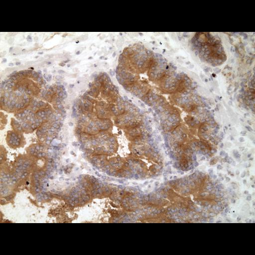  NCBI Organism:Homo sapiens; Cell Types:endocrine-paracrine cell of prostate gland, basal cell of prostate epithelium, luminal cell of prostate epithelium, blood vessel endothelial cell, perineural cell, sheath cell, leukocyte, prostate stromal cell, smooth muscle cell of prostate; Cell Components:nucleus, cell surface;