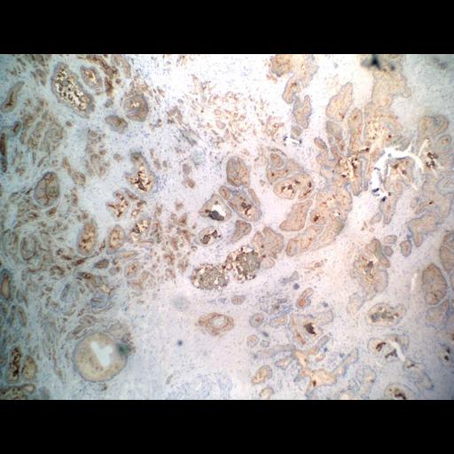  NCBI Organism:Homo sapiens; Cell Types:endocrine-paracrine cell of prostate gland, basal cell of prostate epithelium, luminal cell of prostate epithelium, blood vessel endothelial cell, perineural cell, sheath cell, leukocyte, prostate stromal cell, smooth muscle cell of prostate; Cell Components:nucleus, cell surface;