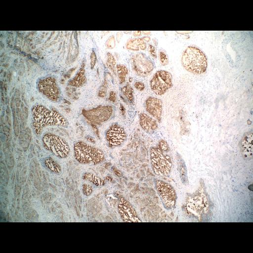  NCBI Organism:Homo sapiens; Cell Types:endocrine-paracrine cell of prostate gland, basal cell of prostate epithelium, luminal cell of prostate epithelium, blood vessel endothelial cell, perineural cell, sheath cell, leukocyte, prostate stromal cell, smooth muscle cell of prostate; Cell Components:nucleus, cell surface;