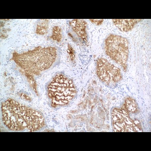  NCBI Organism:Homo sapiens; Cell Types:endocrine-paracrine cell of prostate gland, basal cell of prostate epithelium, luminal cell of prostate epithelium, blood vessel endothelial cell, perineural cell, sheath cell, leukocyte, prostate stromal cell, smooth muscle cell of prostate; Cell Components:nucleus, cell surface;